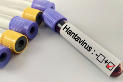 Hantavirüs Bir Salgına Dönüşür mü?