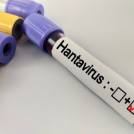Hantavirüs Bir Salgına Dönüşür mü?